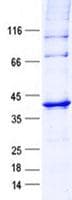 Human PDHB Protein (Recombinant His, N-Terminal)