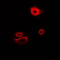 MYOT / Myotilin Antibody