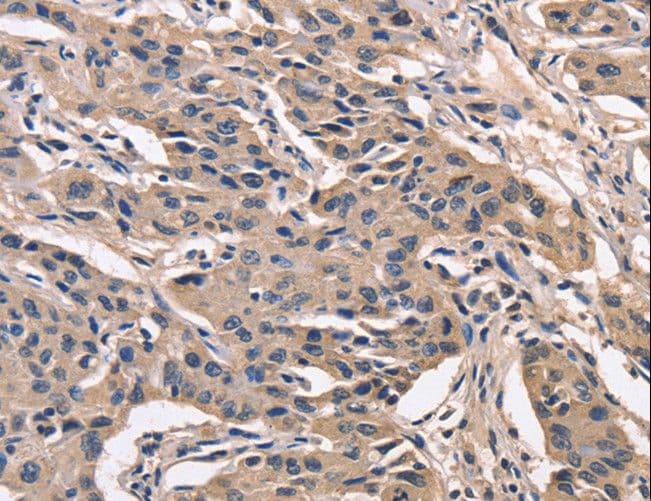 PEBP1 / RKIP Antibody