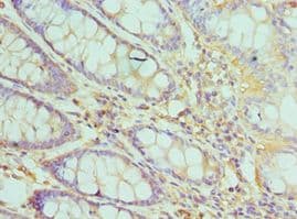 TFDP1 Antibody (aa1-290)