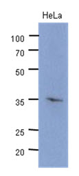 CDK4 Antibody (clone AT6D10)