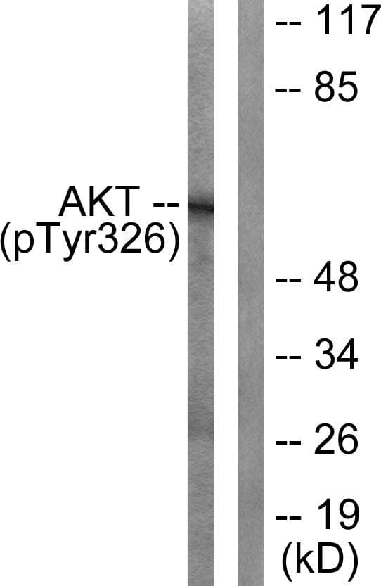 Polyclonal Rabbit anti-Human AKT1 Antibody (phospho-Tyr326, WB)