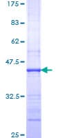 Human PIGR Protein (Recombinant GST, N-terminus)