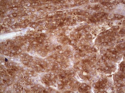 Monoclonal Mouse anti-Human MTOR Antibody (clone OTI5B8, aa1766-2144, IHC, WB)