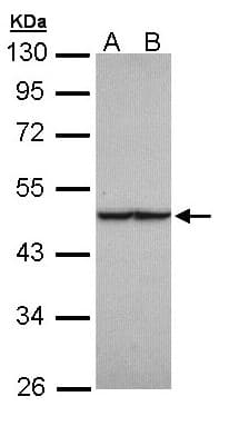 IHC-plus™ FH / Fumarase / MCL Antibody (aa195-473)