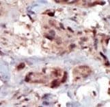 SPHK2 Antibody (aa590-620)