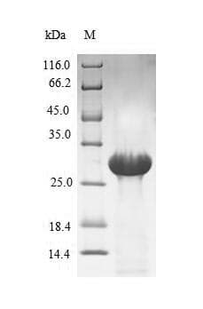 Human F7 / Factor VII Protein (Recombinant 6His-SUMO, N-terminus)
