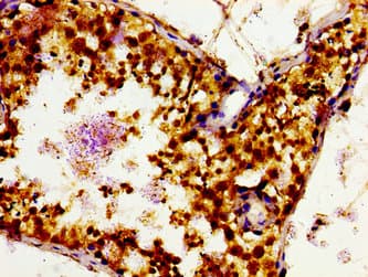 Polyclonal Rabbit anti-Human SLC16A12 / MCT12 Antibody (IHC, WB)