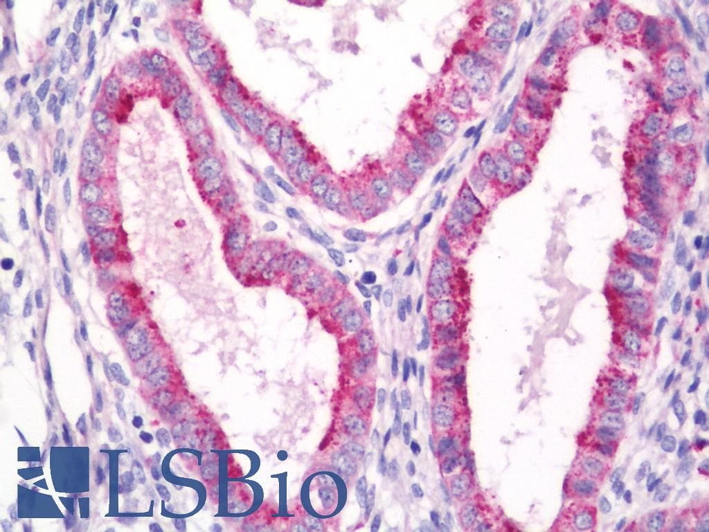 IHC-plus™ Monoclonal Rabbit anti-Human Betaglycan / TGFBR3 Antibody (clone D11G10, Extracellular Domain, IHC, WB)