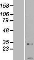 Human AK2 / Adenylate Kinase 2 Protein (Over-Expression Lysate Myc-DDK (Flag))
