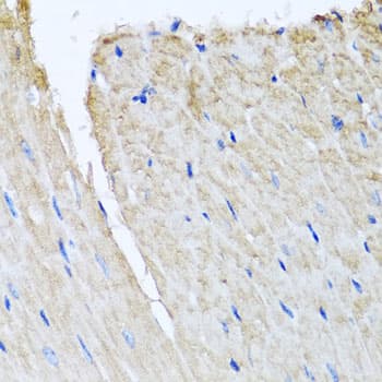 KIAA0153 / TTLL12 Antibody
