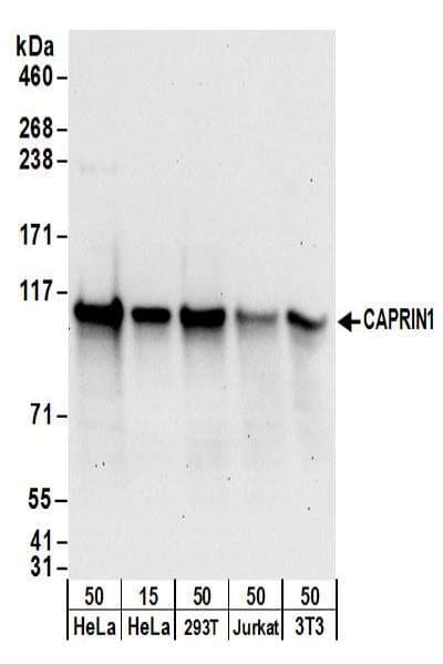 IHC-plus™ CAPRIN1 Antibody (aa550-600)