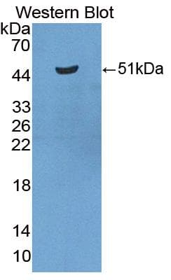 RTN1 / Reticulon 1 Antibody