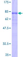 Human LIPH / Lipase Member H Protein (Recombinant GST)