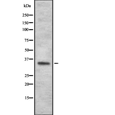 Polyclonal Rabbit anti-Human OR4N2 Antibody (IHC, WB)