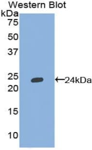 TNFSF13 / APRIL Antibody (aa92-250)