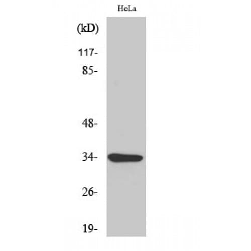 MC2R / ACTHR / ACTH Receptor Antibody (220-300 aa, C-terminal)
