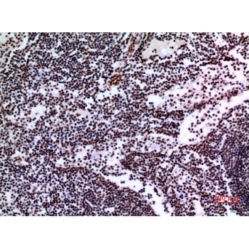 Polyclonal Rabbit anti-Human TP73 / p73 Antibody (IHC, WB)