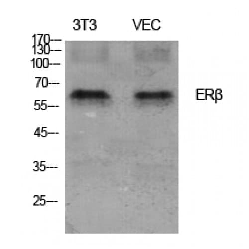 ESR2 / ER Beta Antibody (40-120 aa)