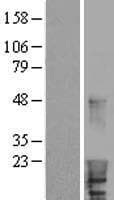 HBXIP Protein (Over-Expression Lysate Myc-DDK (Flag))