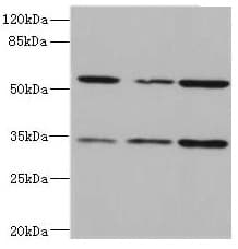 IL17RB Antibody