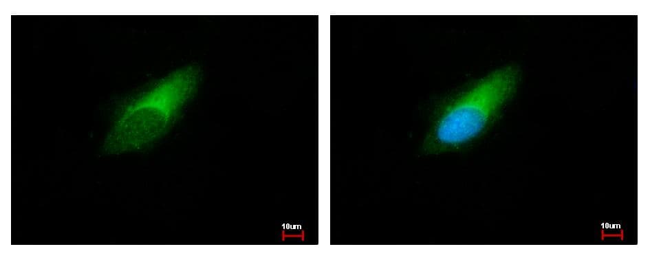 ENSA Antibody