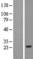 TIPRL / TIP Protein (Over-Expression Lysate Myc-DDK (Flag))