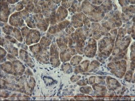 SERPINB3 Antibody (clone OTI3C2)