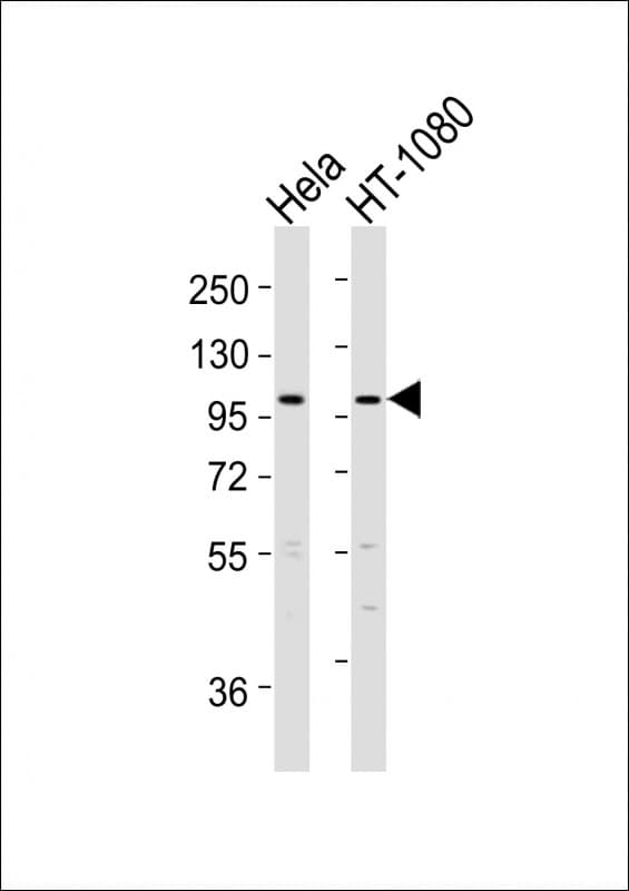 ADAMTS6 Antibody (aa118-151)
