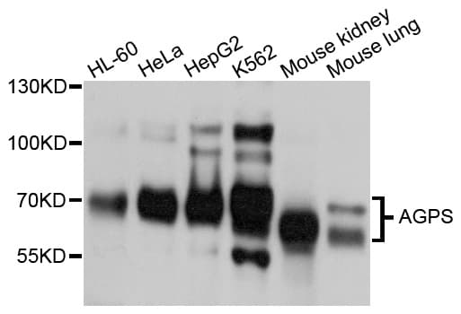 Polyclonal Rabbit anti-Human AGPS Antibody (WB)