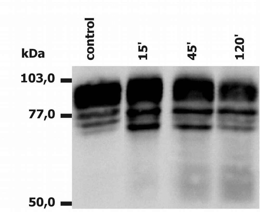 ITGB2 / CD18 Antibody (clone MEM-148)