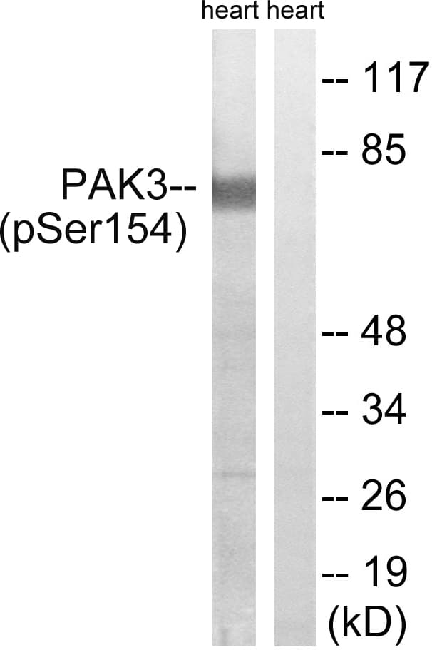 Polyclonal Rabbit anti-Human PAK3 Antibody (phospho-Ser154, IHC, WB)