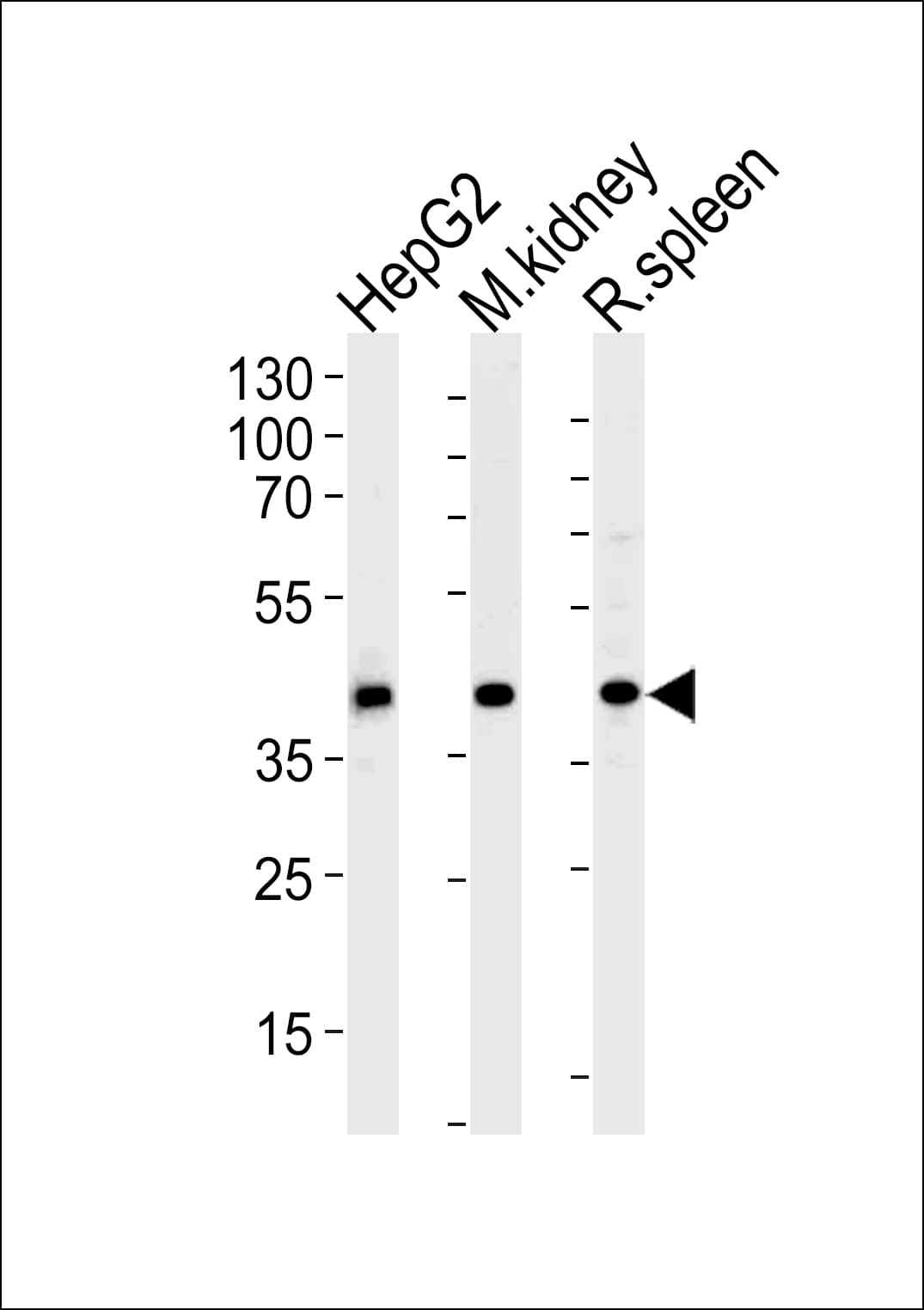 ACADL Antibody (aa14-43)