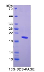 Bovine NPPA / ANP Protein (Recombinant His-S)