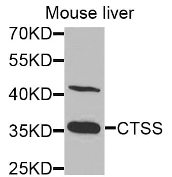 Polyclonal Rabbit anti-Human CTSS / Cathepsin S Antibody (IHC, WB)