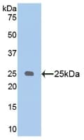 NPEPPS Antibody (aa584-793)