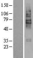 SLC22A5 / OCTN2 Protein (Over-Expression Lysate Myc-DDK (Flag))