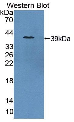FOLH1 / PSMA Antibody (aa275-588, Biotin)