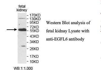 Polyclonal Rabbit anti-Human EGFL6 Antibody (aa30-219, IHC, WB)