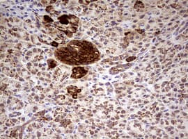 HADH Antibody (aa57-314, clone OTI1B11)