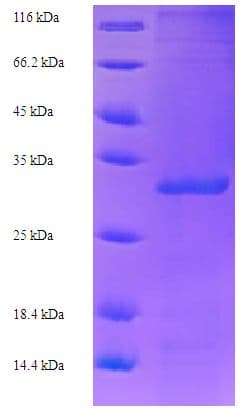Human Protein E6 (Recombinant His-SUMO)