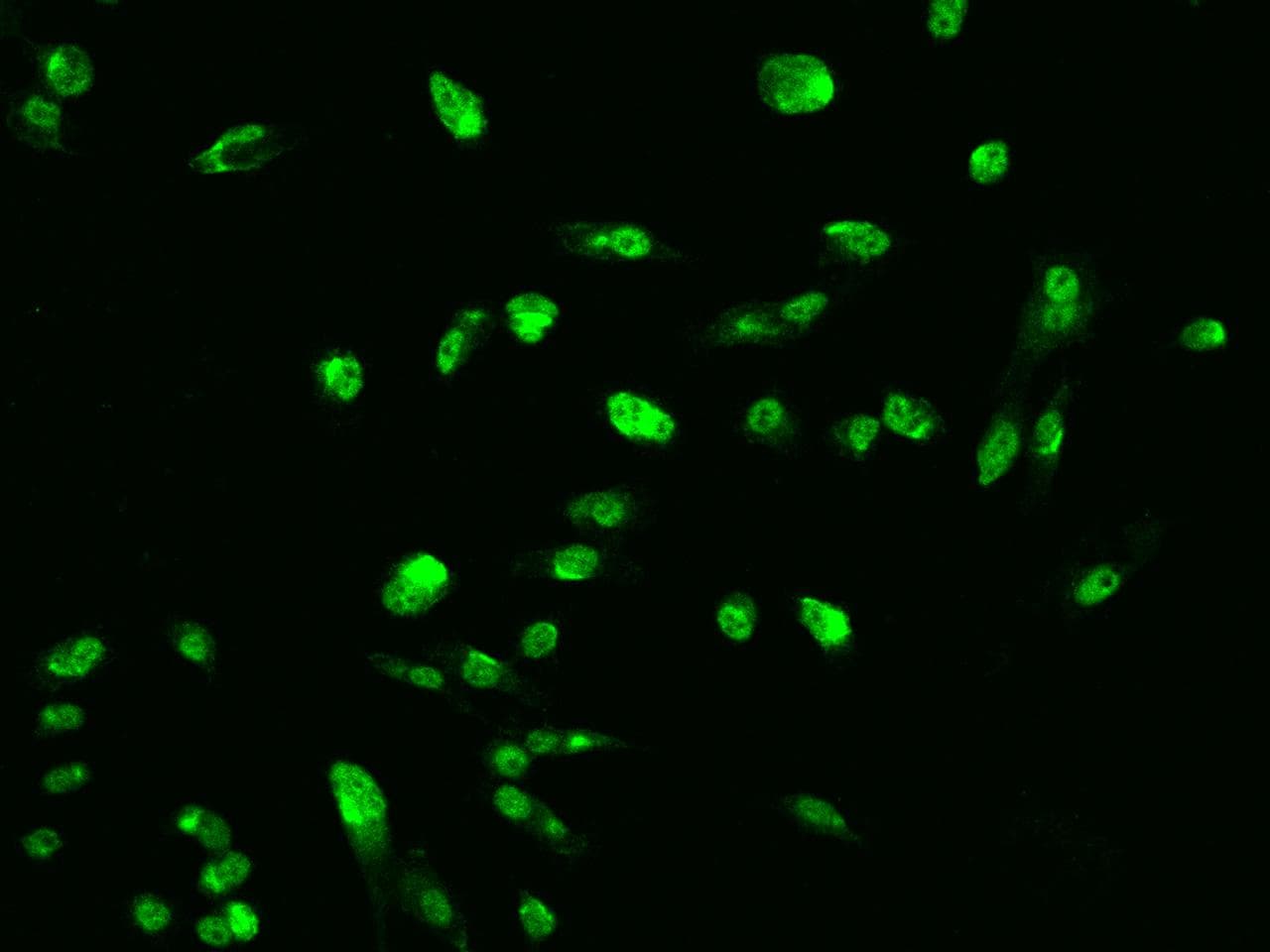 Polyclonal Rabbit anti-Human ARRDC2 Antibody (IF)