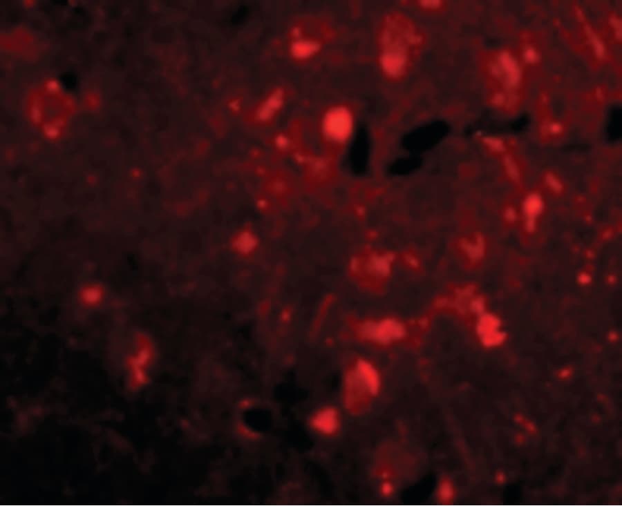 IHC-plus™ SLITRK2 Antibody