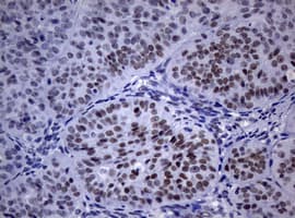 NBN / Nibrin Antibody (clone OTI6D10)