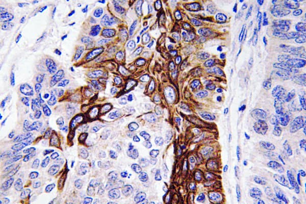 SLC2A4 / GLUT-4 Antibody (aa222-271)