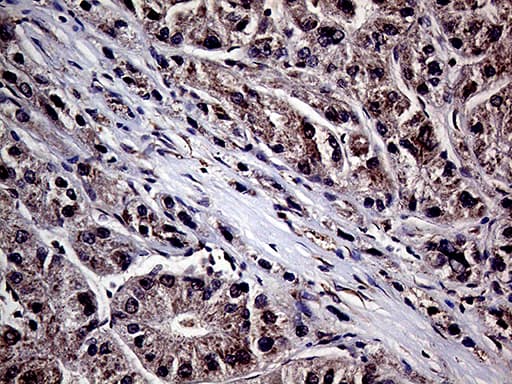 Monoclonal Mouse anti-Human HABP2 Antibody (clone OTI5H3, aa33-330, IHC, WB)