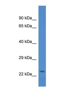 CSRP2 Antibody (aa90-139)