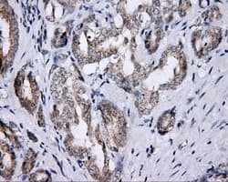 LIPG / Endothelial Lipase Antibody (clone OTI2A5)