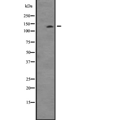 TTBK2 Antibody
