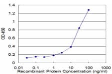 ADAMTS1 Antibody (clone 1B8)